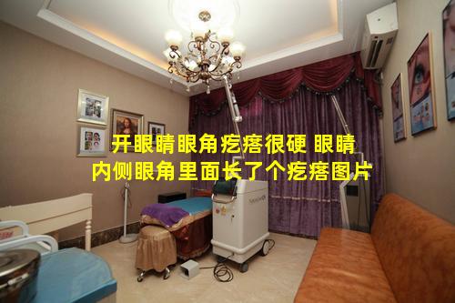 开眼睛眼角疙瘩很硬 眼睛内侧眼角里面长了个疙瘩图片